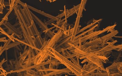 Young woman fights Mesothelioma aged just 23 after coming into contact with Asbestos as a child
